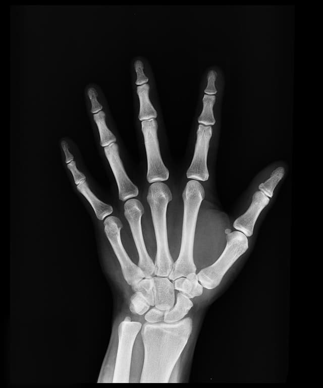 hand-bone